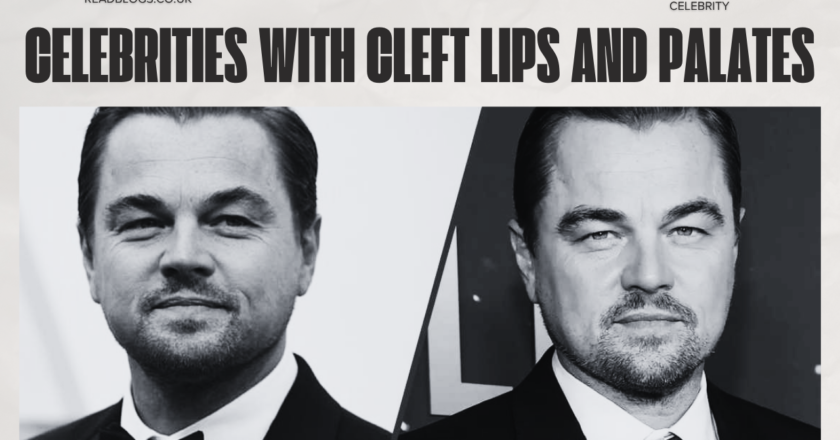 Celebrities With Cleft Lips and Palates: Inspiring Stories